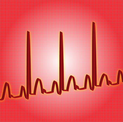 31. Rhythm - Adrenaline Junkies and Template Zombies: Understanding ...