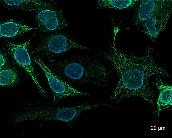 Human-derived SK8/18-2 cells. These cells are stained to highlight their nuclei and cytoskeletons and imaged using fluorescence microscopy.