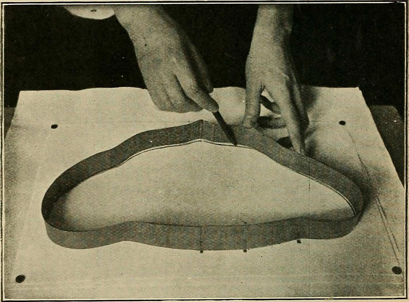 Image from page 61 of "X-ray observations for foreign bodies and their localisation" (1920).