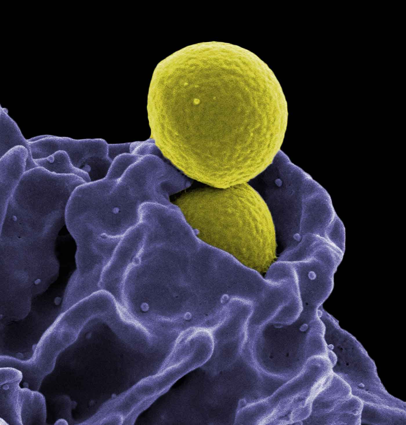 A bacterium being ingested by an immune cell.