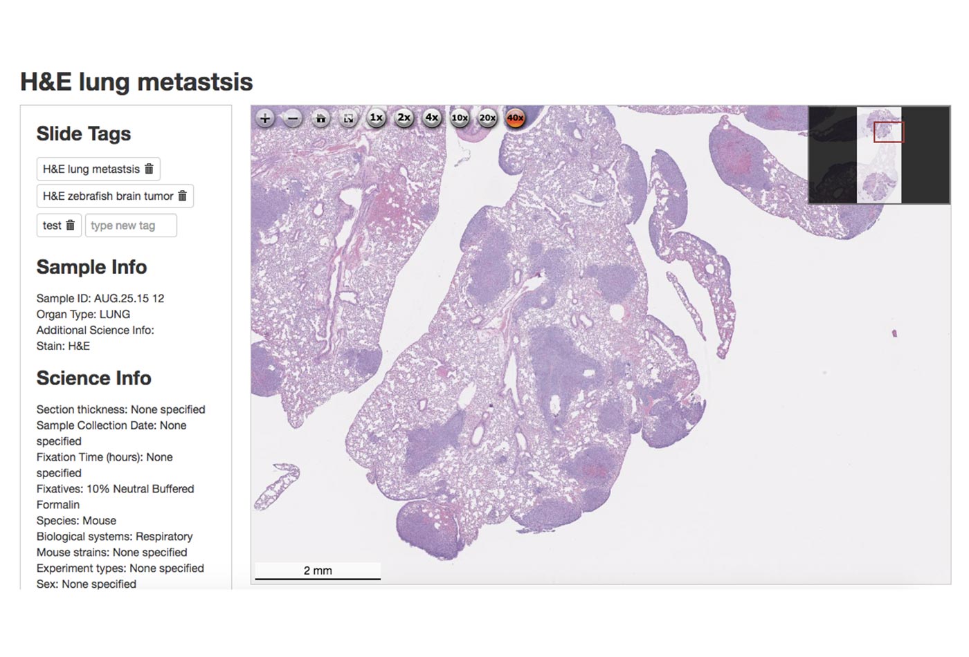 An H&E stained slide of metastatic murine lung cancer, available in HistoWiz’ demo slide gallery