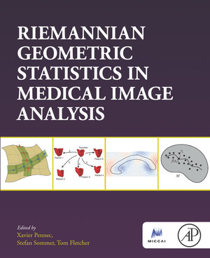 Visual Computing for Medicine 第2版 Visual Computing for Medicine, 2nd Edition [Book]