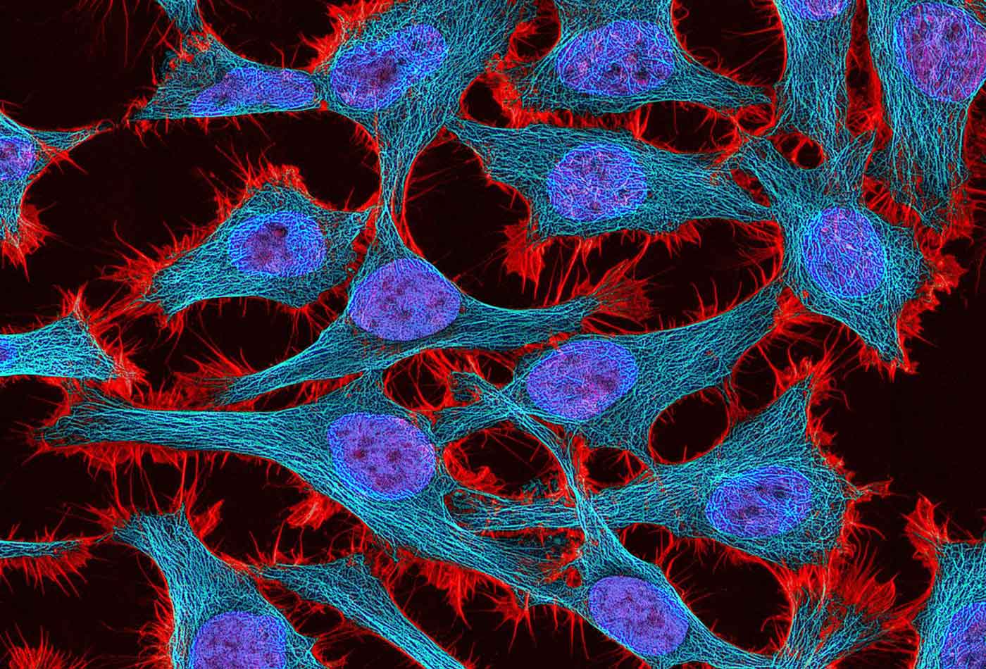 Multiphoton fluorescence image of HeLa cells